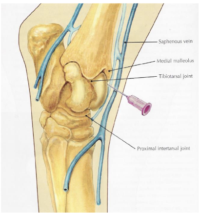 <p>what is desensitized in a tibiotarsal joint block (<strong><em>dont hit saphenous vein)</em></strong></p>