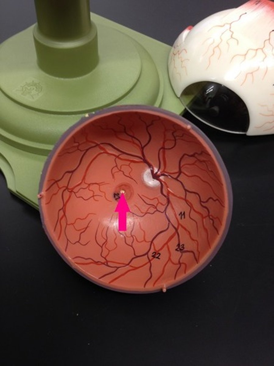 <p>Identify the yellow dot.</p>