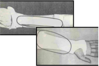 <p>Name this static splint component. What’s its function?</p>
