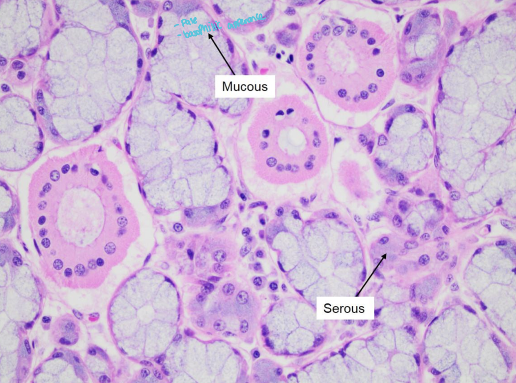 See Image 