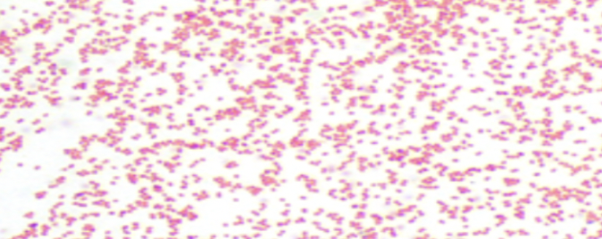 <p><span style="font-family: "Times New Roman", serif;">Which organism is shown in this image?</span></p>