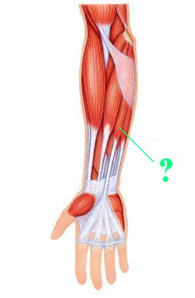 <p><span>Identify the indicated muscle.</span></p>