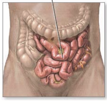 <p>Composed of three non-visually distinct regions, each having different cells types and muscles: duodenum, jejunum, ileum. Surface area = 30m<sup>2</sup></p><p>Main site for<strong> nutrient digestion</strong> and <strong>absorption</strong> (the <u>nutrient gateway</u>).</p><p>Intestinal motility controlled by <strong>longitudinal </strong>(squeezes fluid down) and <strong>circular </strong>(contricts) muscles.</p><p>Chyme acidity is <strong>neutralized</strong> by <strong>pancreatic juice</strong> (which contains bicarbonate).</p><p>Food is digested by <strong>pancreatic juice</strong> and <strong>bile acids</strong> (made in liver, stored in gallbladder).</p>