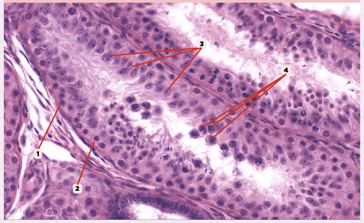 <p>Identify the structure labeled as 3.</p>