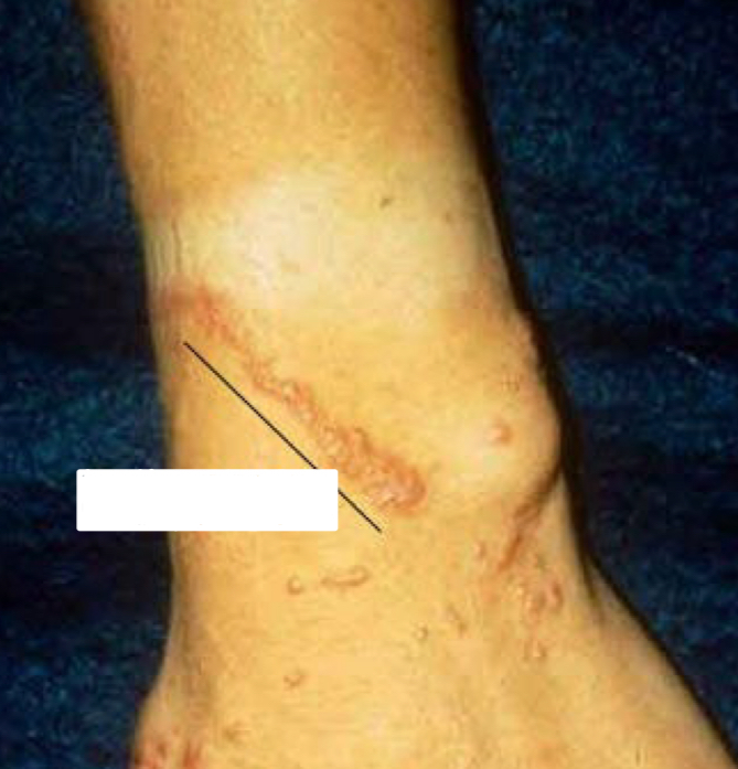 <p>what shape/arrangement is depicted</p>