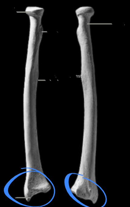 <p>Articulated with the carpels of the manus, located on the radius </p>