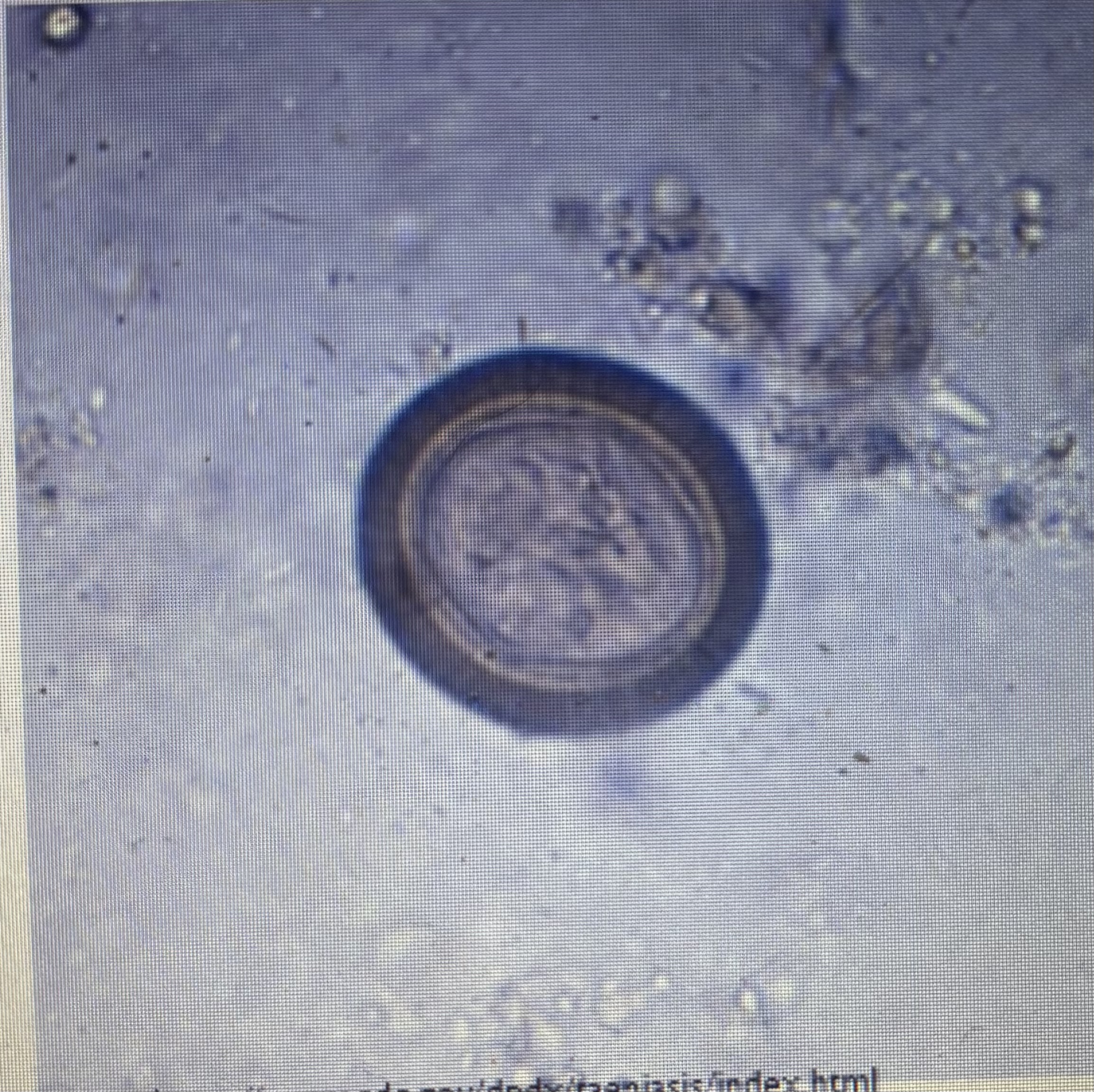 <p>Small rodent intermediate host </p><p>Host species - cat</p>