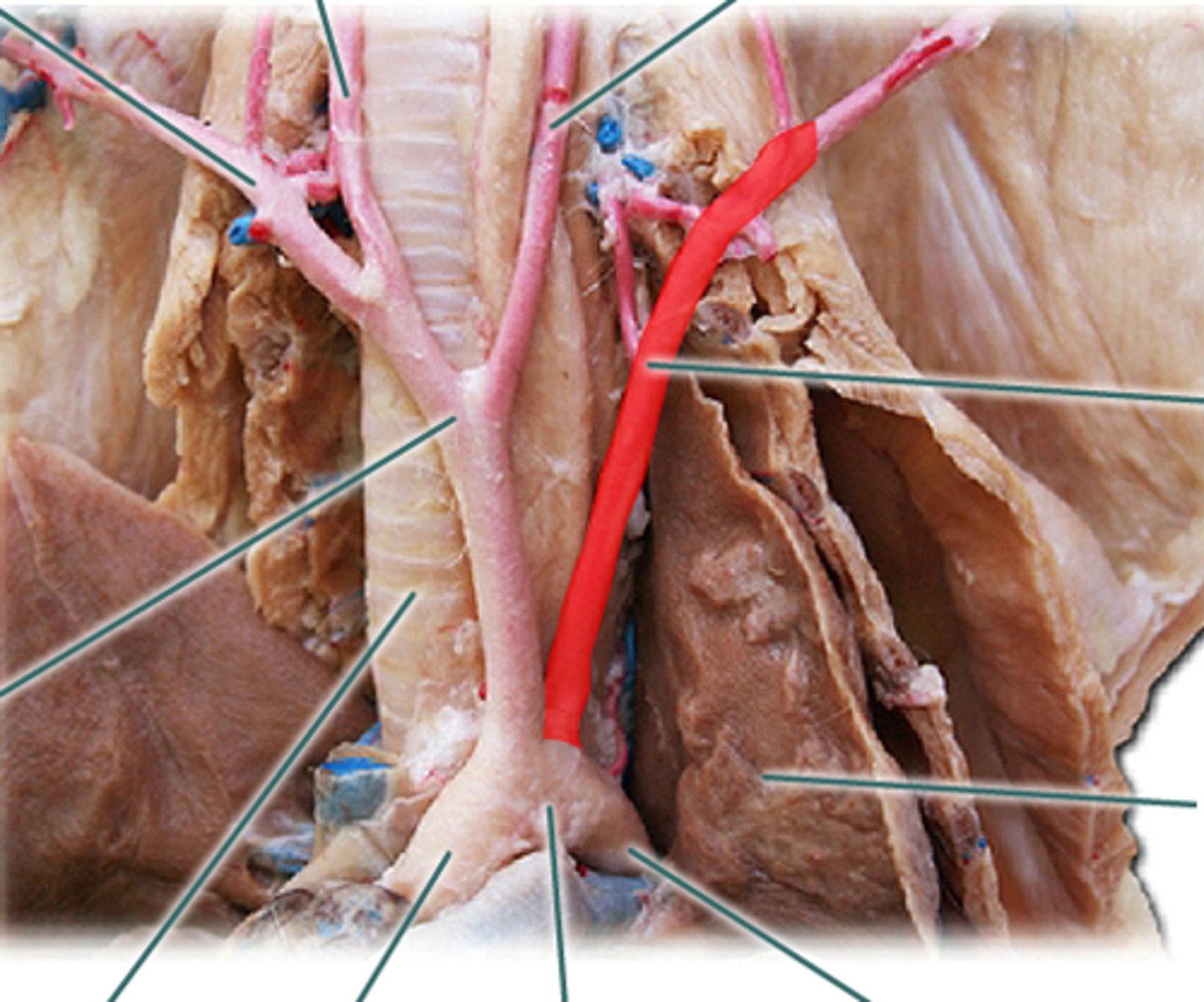 <p>left branch off the aortic arch</p>