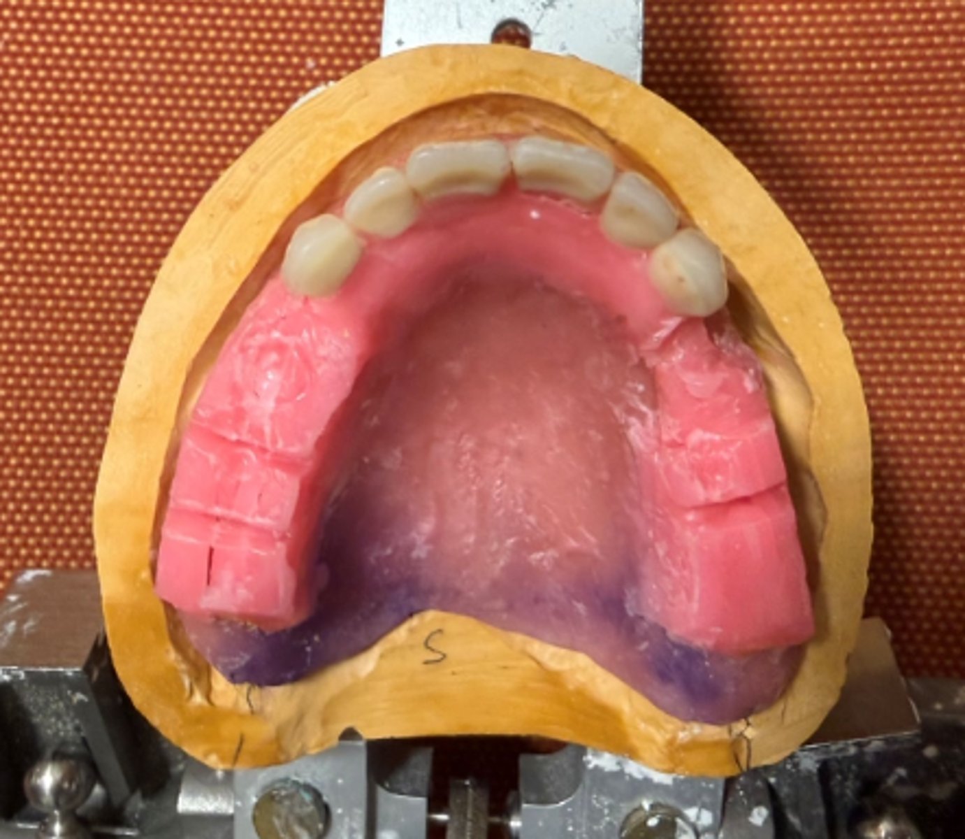 <p>Did the student use proper type of dental stone to form this working cast for the dental prostheses?</p>