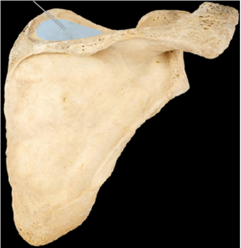 Which of the following muscles originates on the highlighted structure?