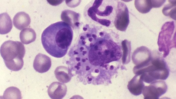 <p>in human</p><p>red papule at bite, warty nodular eruptions</p><p>Mediterranean Sea and east to Russia + China, or West and South to Asia, Central Africa, NE Africa</p>