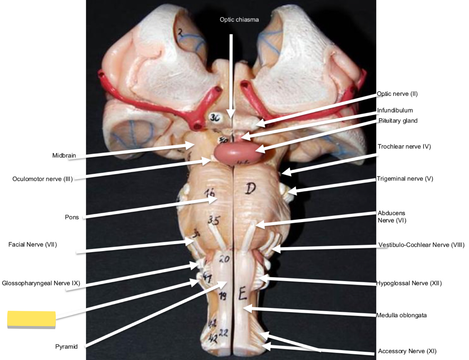 <p>Name this cranial nerve&nbsp;</p>
