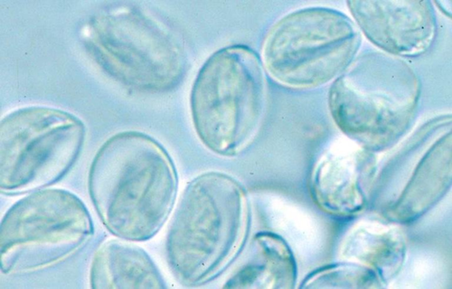 <p>These structures were found on the fecal flotation of a dog with diarrhea. They are approximately 12x8 µm. What are they?</p>
