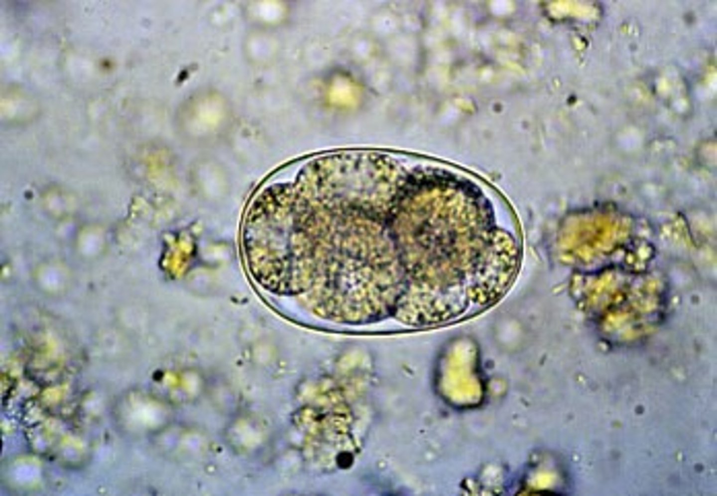 <p>This was found in a stool sample of a dog with bloody stool. What is it?</p>