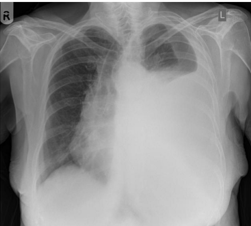 <p>whats the dx?</p>