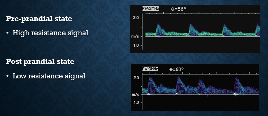 <p>pre : high resistance</p><p>post : low resistance </p><ul><li><p>sends more blood to bowel </p></li><li><p>EDV should double </p></li></ul><p></p>