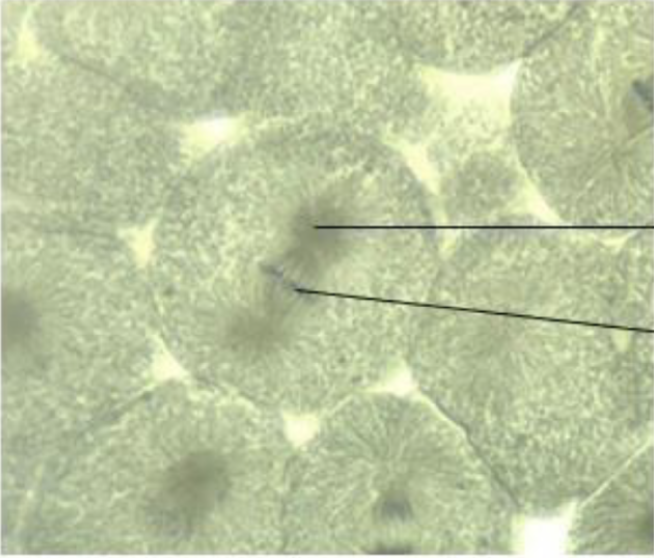 <p>What is the phase of the cell? What do the pointers point to?</p>