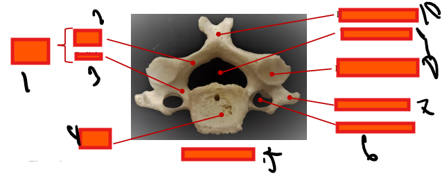 <p>where is the transverse process</p>