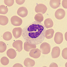<p>What is this neutrophil showing?</p>