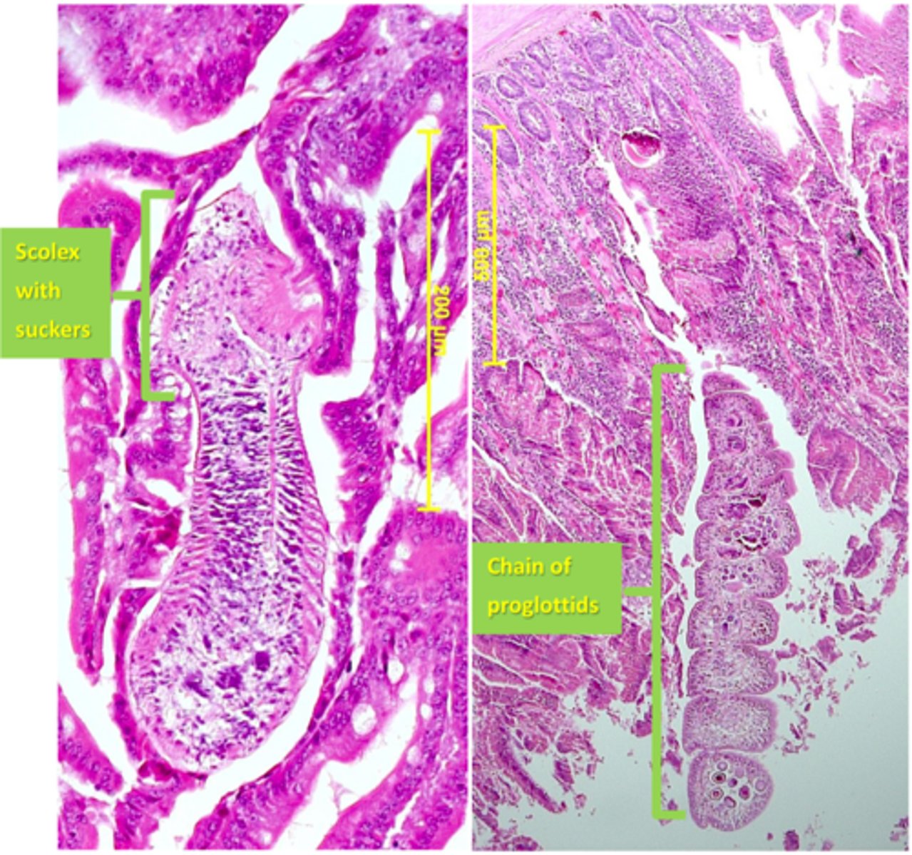 <p>Station 4:</p><p>The histological sections (H&amp;E staining) on the attached microscope and shown below arefrom the small intestine of a bird that was culled because it broke one of its legs. Q1: What type of parasite can you see on the microscope?</p>