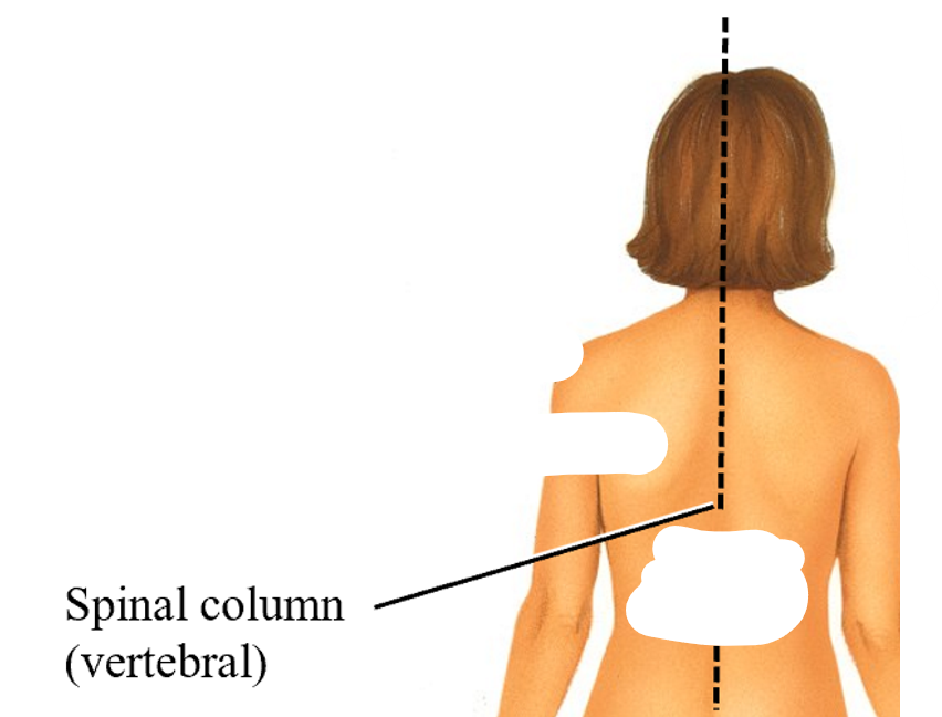 <p>vertebral</p>