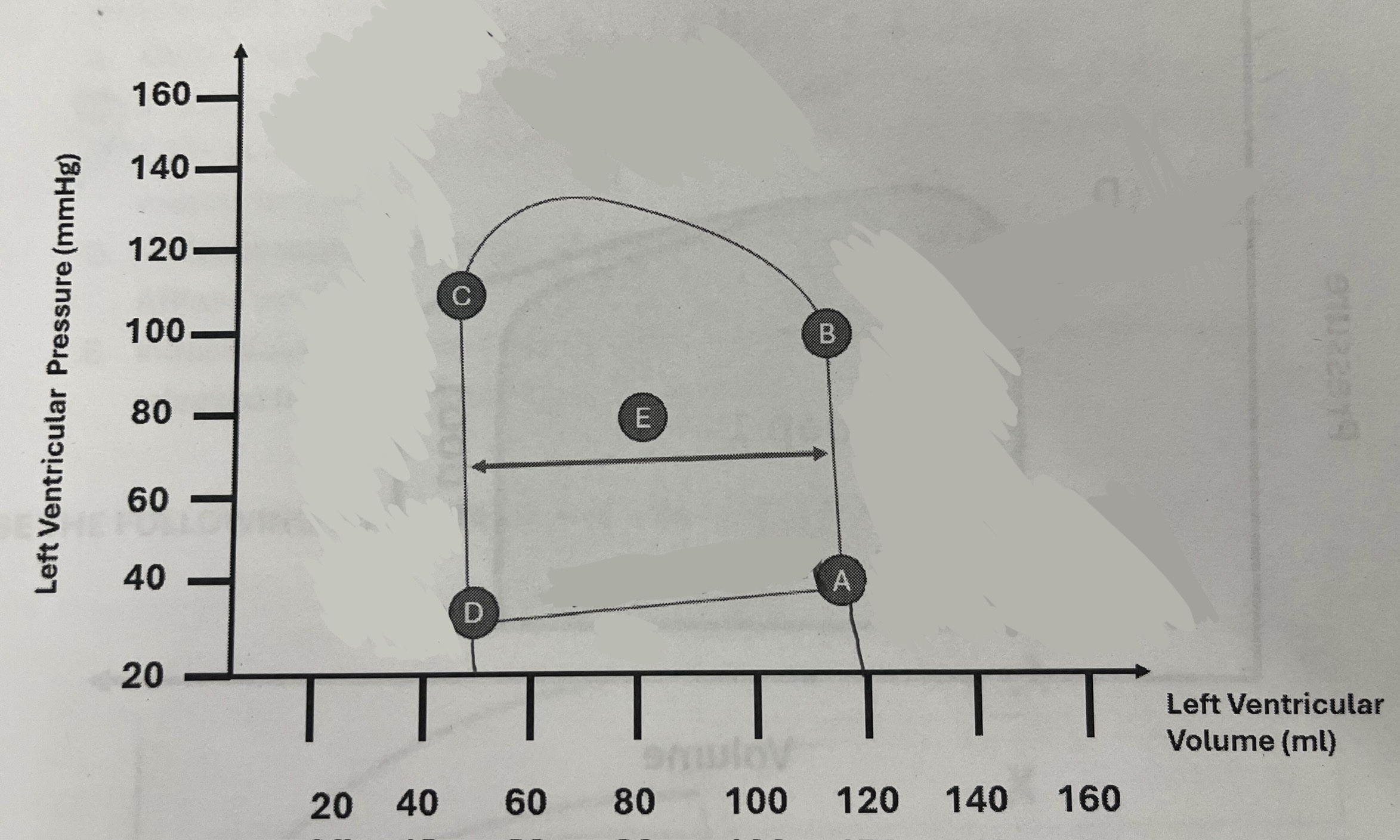 <p>What is the approximate stroke volume of the patient?</p>