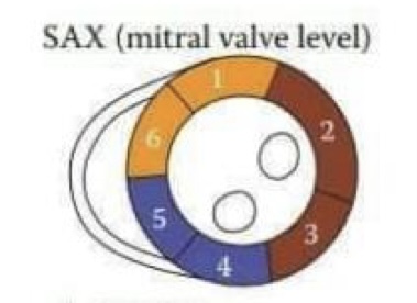 <ol><li><p>Anterior (LAD)</p></li><li><p>Anterolateral (LCx)</p></li><li><p>Inferolateral (LCx)</p></li><li><p>Inferior (RCA)</p></li><li><p>Inferoseptal (RCA)</p></li><li><p>Anteroseptal (LAD)</p></li></ol>