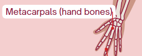 <p><span>Hand bones</span></p>