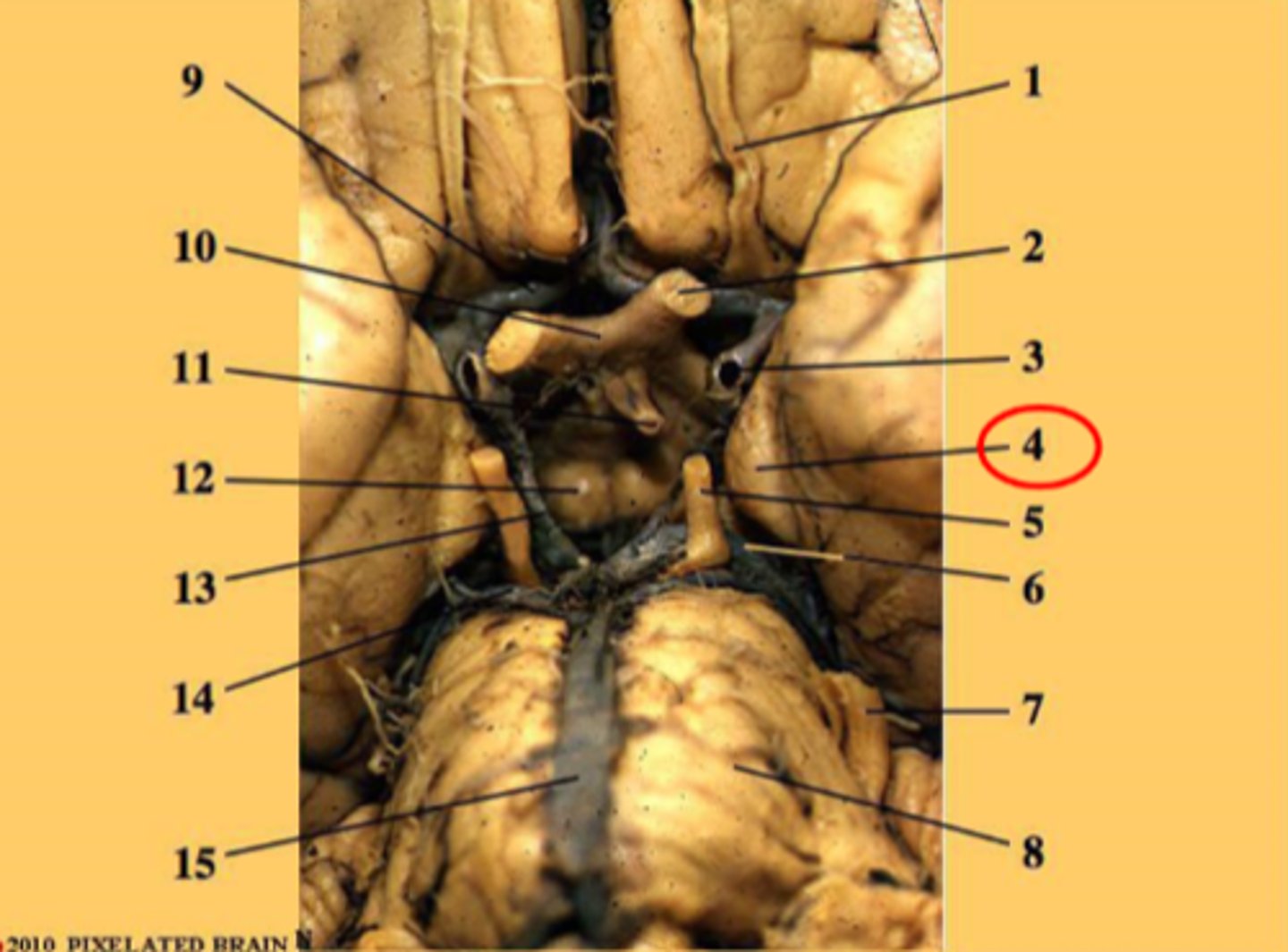 <p>uncas of parahippocampal gyrus (inferior area of temporal lobe) = lateral to the brainstem = lateral to CN III in brainstem</p>