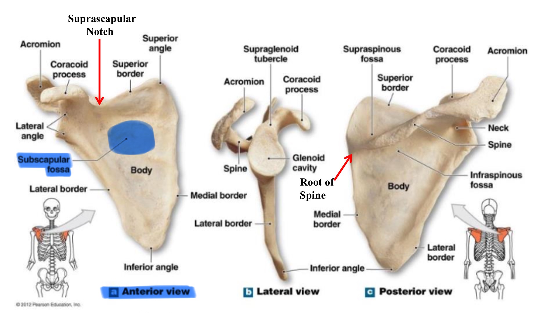 <p>subscapular fossa</p>