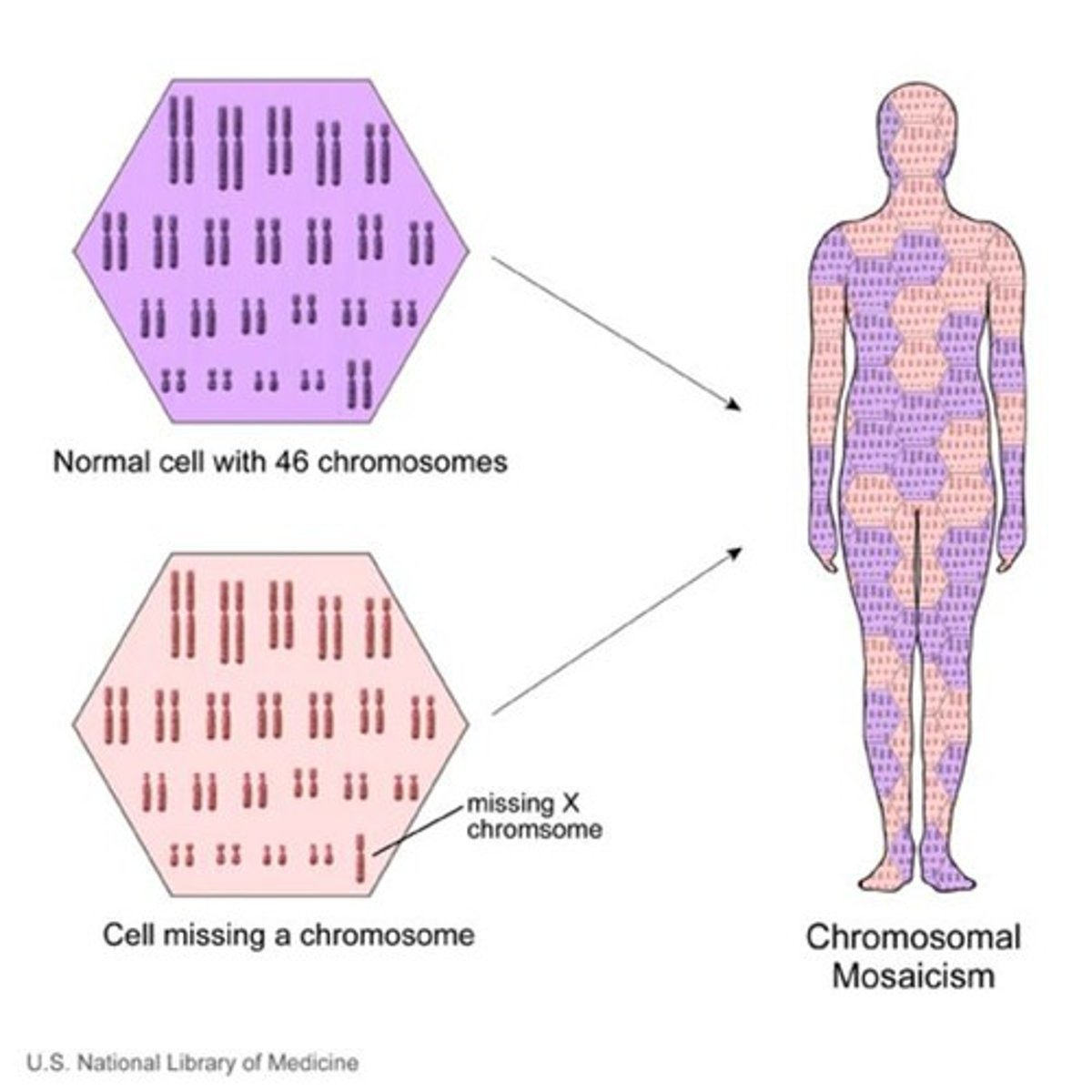 <p>Chromosomal mosaics are trisomies that occur in only some cells of the body, leading to different karyotypes.</p>