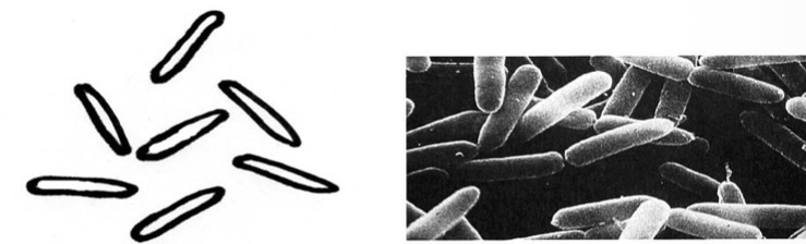 <p>What is the shape of this bacteria </p>