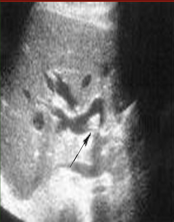 term image