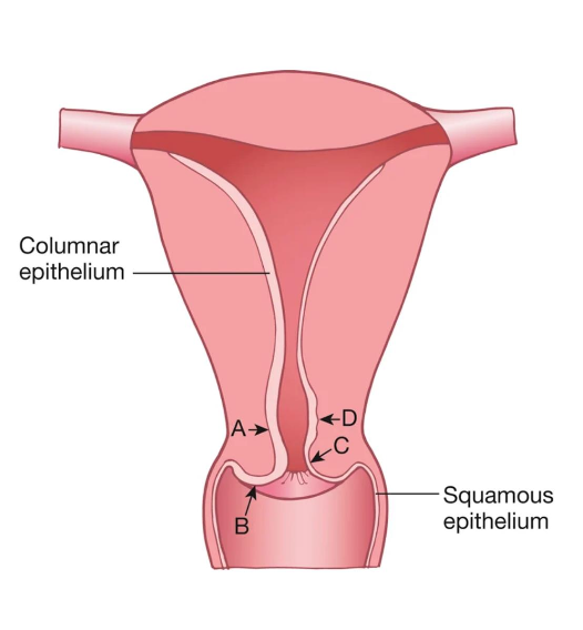 <p>A</p>