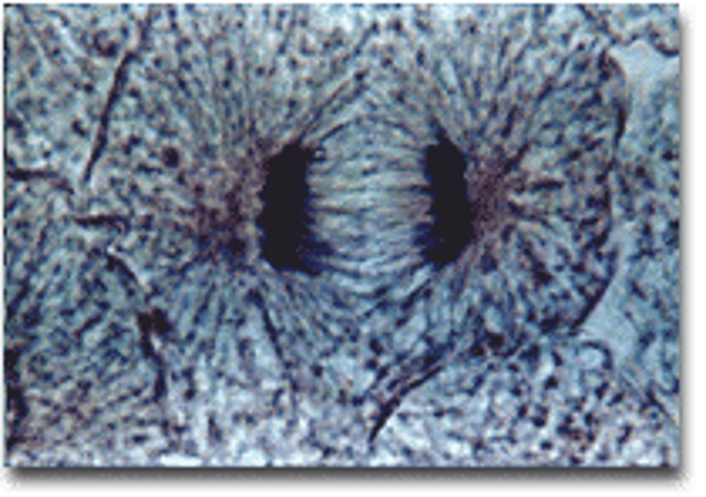 <p>the third phase of mitosis, during which the chromosome pairs separate and move toward opposite poles</p>