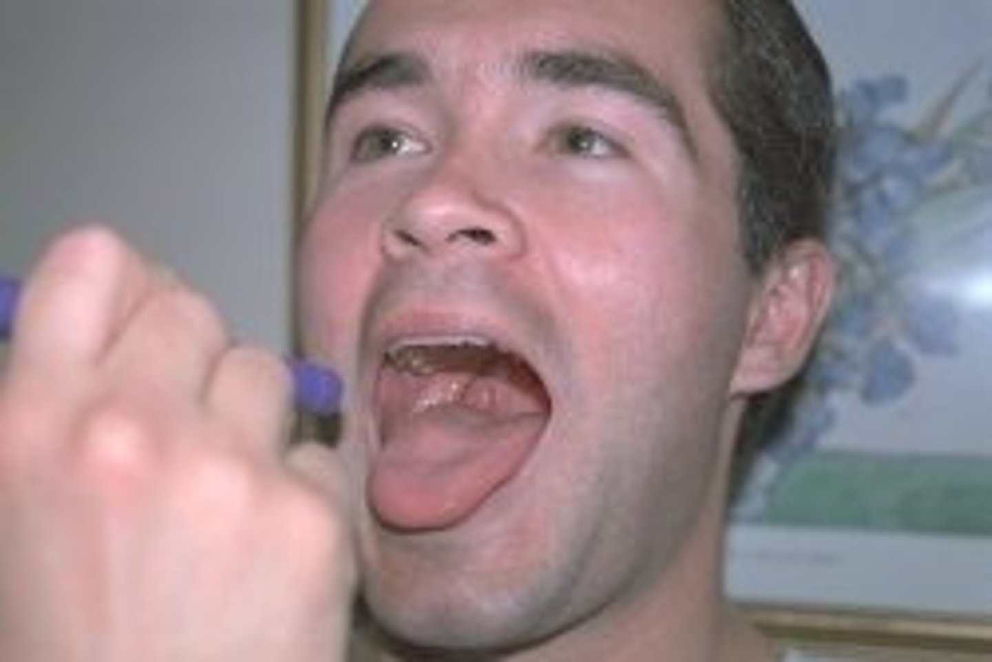 <p>-glossopharyngeal<br>-sensory: taste, general sensory from pharynx &amp; tongue, input from carotid chemoreceptors (O2/CO2) &amp; baroreceptors (BP)<br>-motor: tongue &amp; pharynx (swallowing), parotid salivary gland</p>