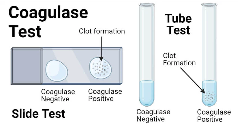 <p>enzyme that produces fibrin from fibrinogen at the site of infection; clot offers protection from phagocytosis</p>