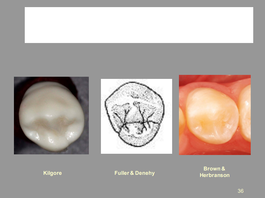 <p>From the Picture Shown, What Tooth Is This, And What View?</p>