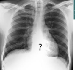 <p>what do u see?</p>