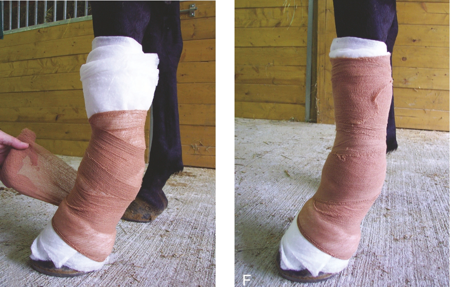 <ul><li><p>The securing layer must be “seated” before it can be pulled tight</p></li><li><p>Circle the padding layer several times</p></li><li><p>Start in the middle and proceed distally with minimal tension</p></li><li><p>Brown gauze can be used to further conform padding so that the compression layer “bites” better</p></li><li><p>Securing layer is seated by applying the material with minimal tension around the middle</p></li><li><p>Then the material is applied distally</p></li><li><p><strong>1 inch of padding visible above and below</strong></p></li><li><p>Compression is applied in a distal-to-proximal direction</p></li><li><p>50% overlap</p></li><li><p>Proper tension is indicated when the waffle pattern is not visible</p></li><li><p>Avoid bunching of padding</p><p></p></li></ul><p></p>