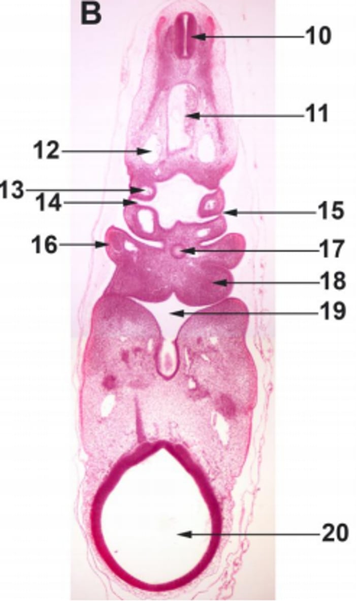 <p>#20 ectoderm</p>