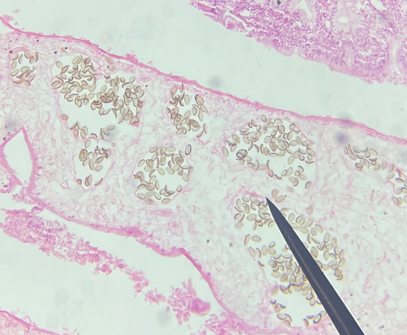 <p>40X magnification</p>