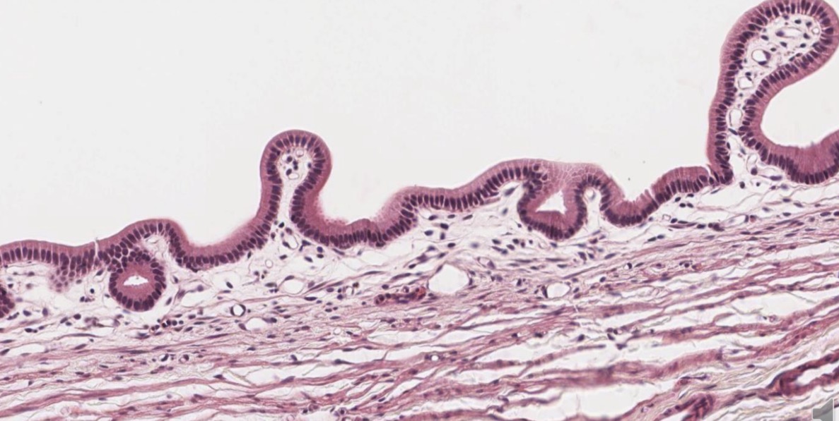 <p>Epitelio monoestratificado cilíndrico vesicula biliar</p>