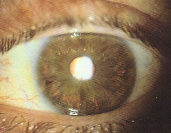 <p>identify </p>