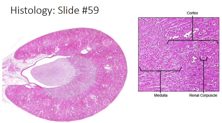 <p>longish white lines in the medulla</p>