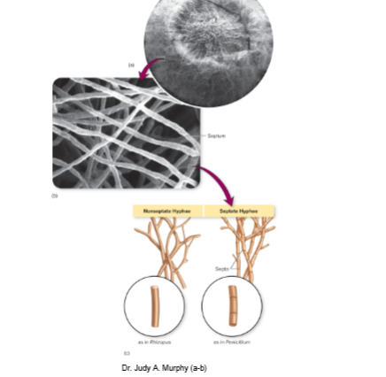 <p>long, single cell chains that can be tightly/loosley woven</p><p>hyphae of mold=haploid</p><ul><li><p>septate hyphae= cross walls called septa that divide hyphae into individual cells</p></li><li><p>nonseptate hyphae= 1 tube that shares nuclei= no septa to create divisions</p><ul><li><p>humans don’t have this because it causes catastrophic events for us</p></li></ul></li></ul><p></p>
