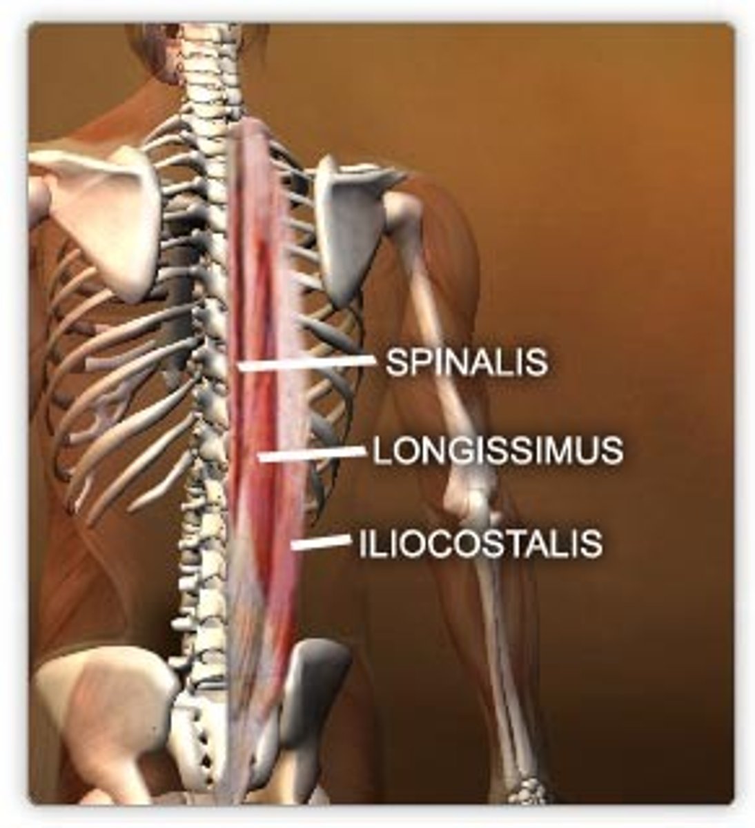 <p>-Iliocostalis</p><p>-Longissimus</p><p>-Spinalis</p>