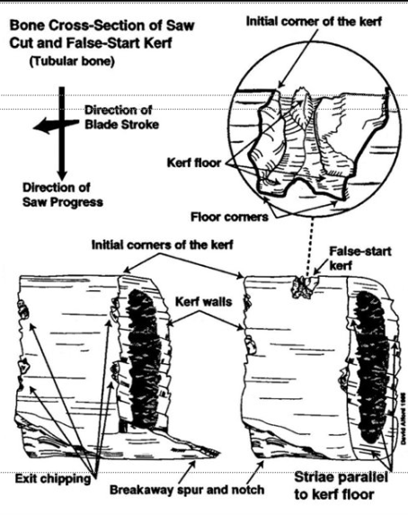 <p><span>the groove or slot left by a cutting tool, like a saw.</span></p><p><span>Walls &amp; floor of cut</span></p><p><span>Provide most info</span></p>