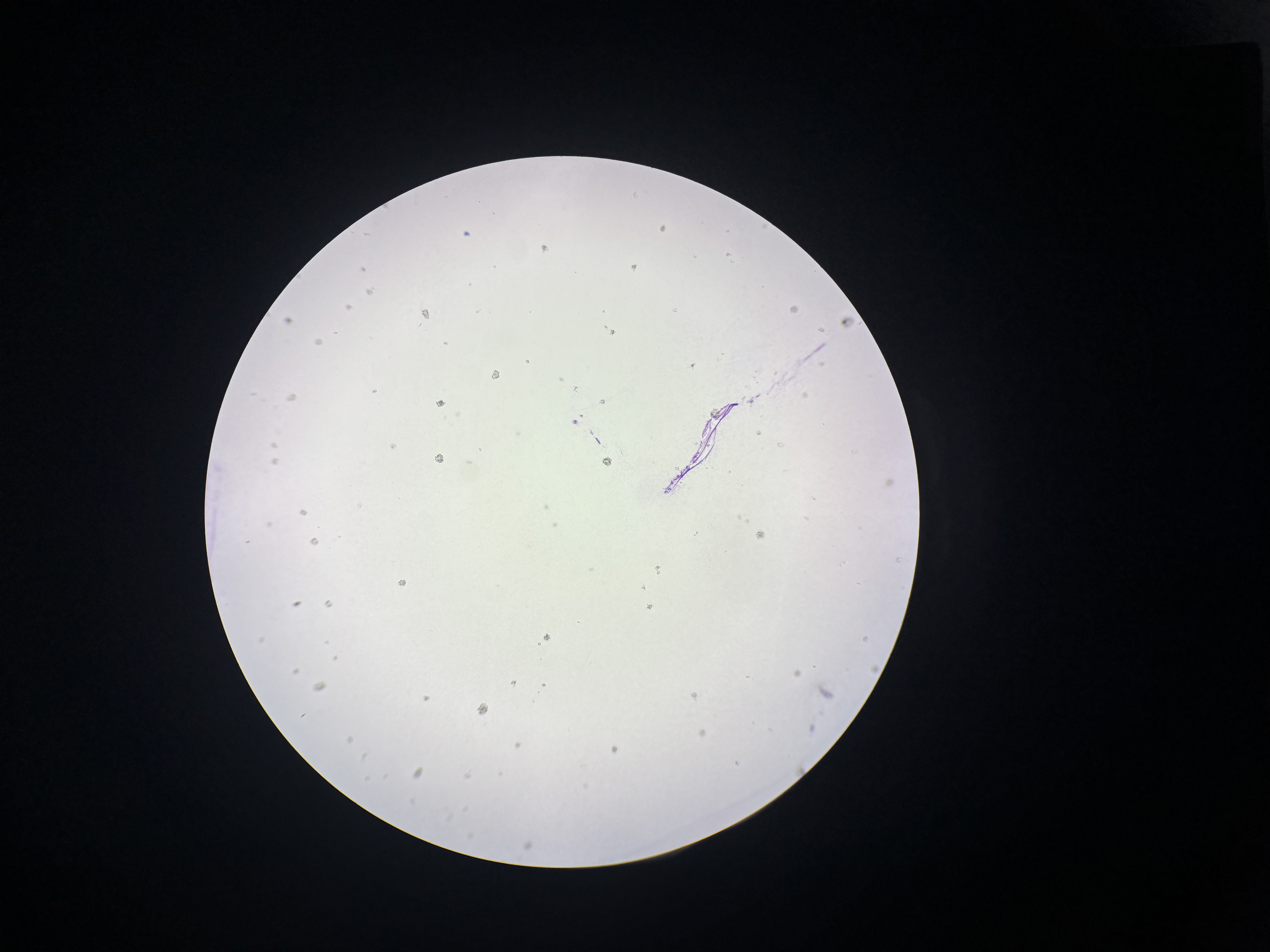 <p><span>Trypanosoma rhodesiense</span></p>