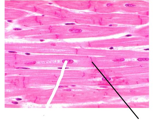 <p>Intercalated Disc</p>